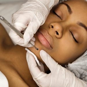 Deep Purifying Treatment at Science of Beauty Annapolis