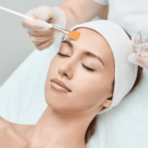 Progressive mini peel at Science of Beauty Annapolis