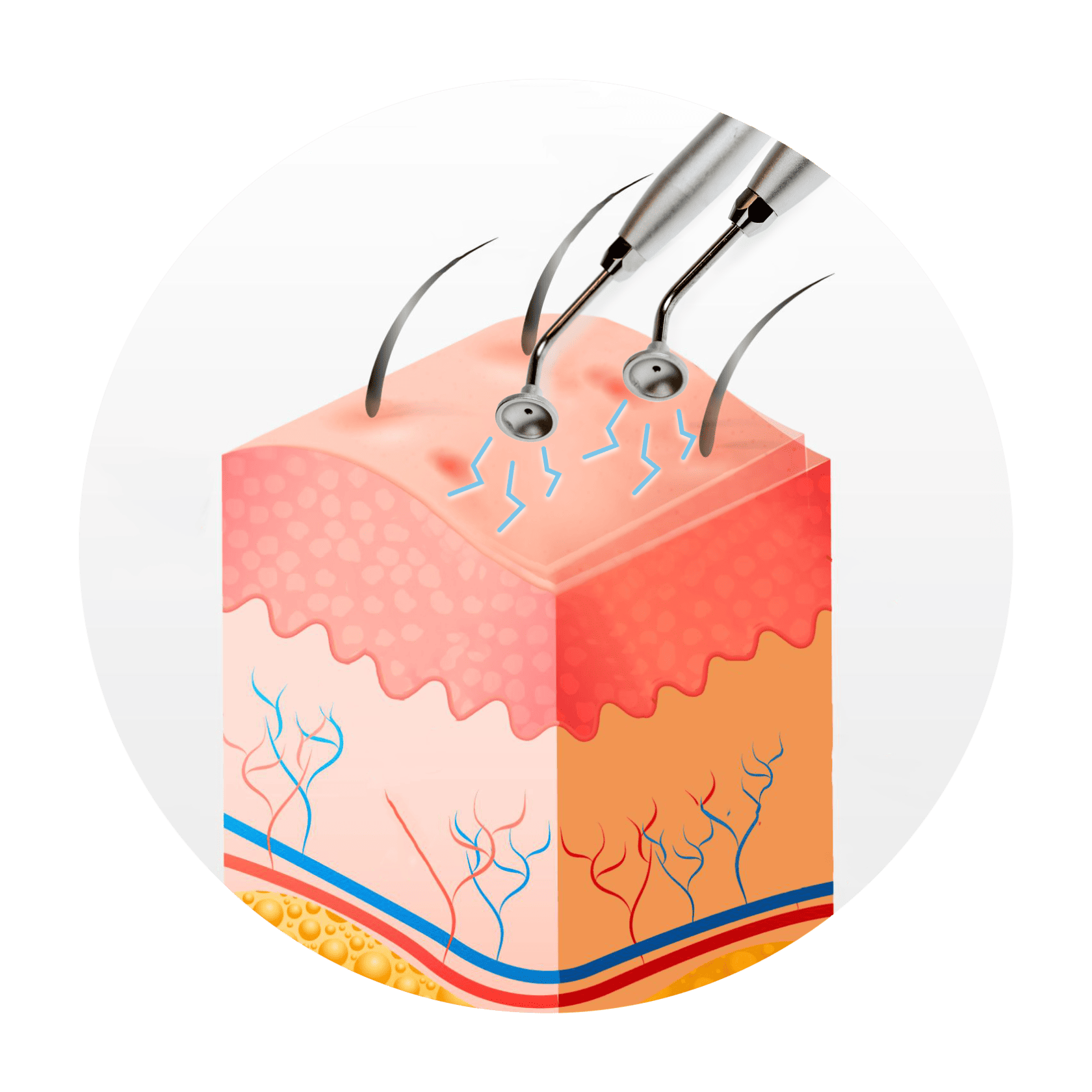 Positive Pulse Pressure Facial Sculpting illustration